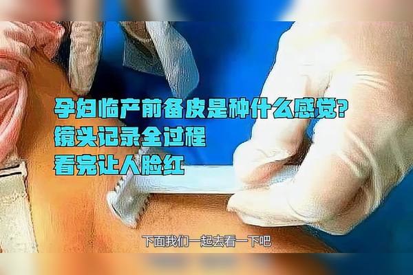 妊娠股皮痒是怎么事？从原因到预防精通解释