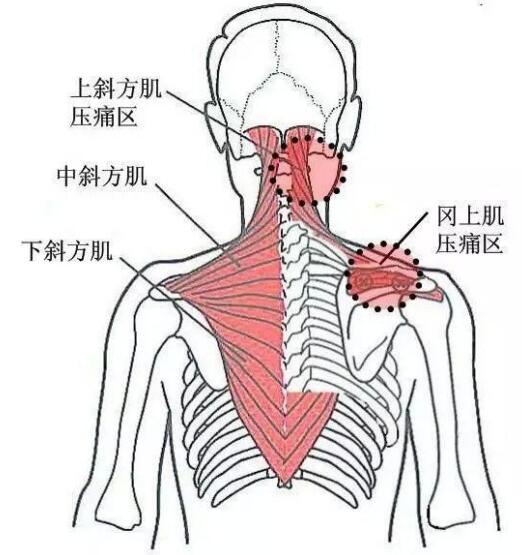 肺疼是怎么回事？深度解析肺部疼痛的常见原因、症状及应对方法