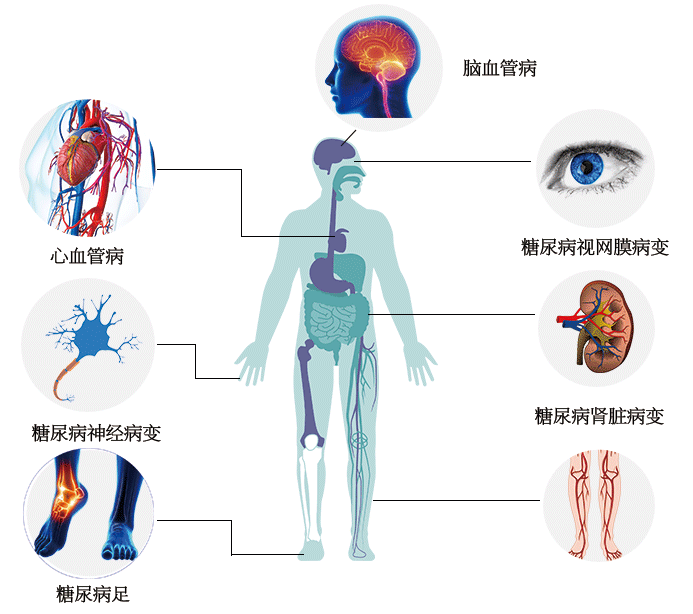 血糖怎么能降下来？深度解析降糖策略及潜在风险