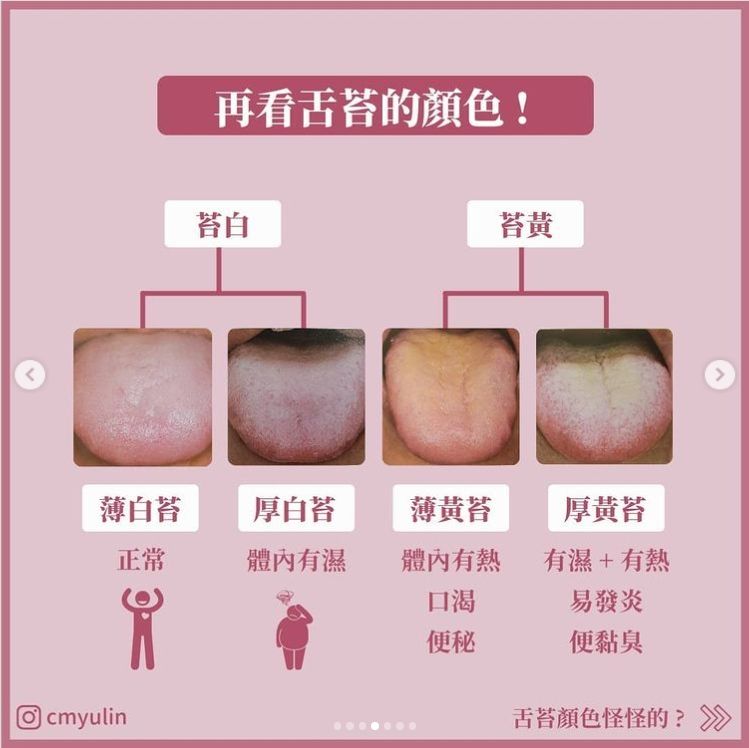 舌苔黑色是怎么回事？深度解析黑色舌苔的成因、症状及应对方法