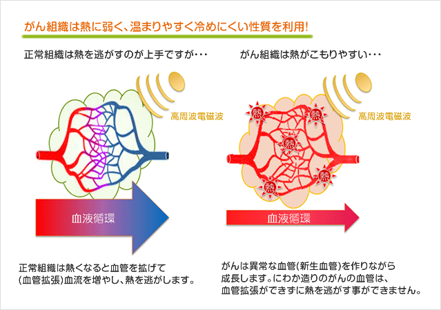 浑身发热是怎么回事？探究原因及应对策略