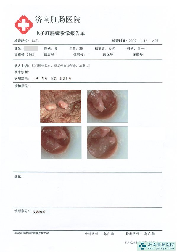 肛周脓肿硬块怎么消掉？专业医生详解治疗方法及居家护理