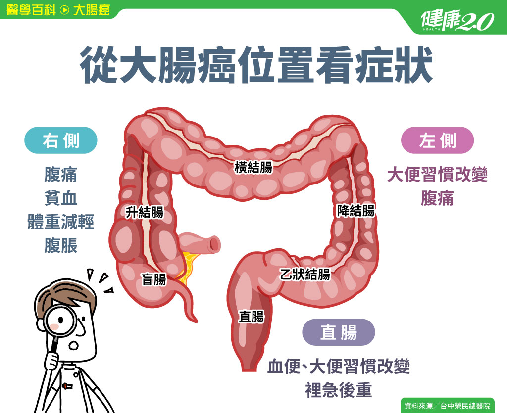 乙状结肠怎么治疗？深度解析治疗方案及潜在风险