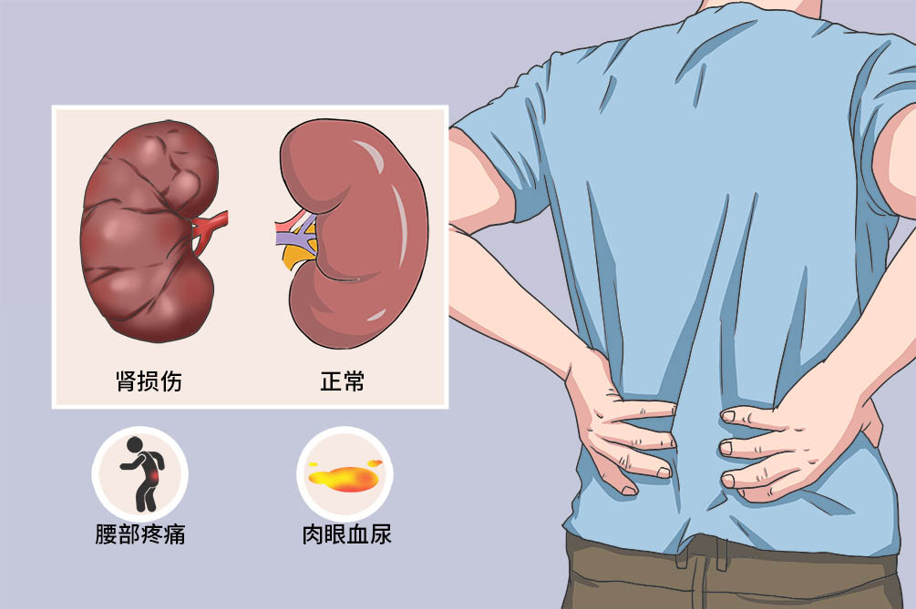 尿多是怎么回事？深度解析多尿症的成因、症状及应对策略