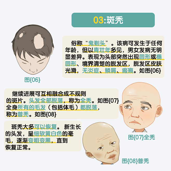 掉头发怎么治疗？从病因分析到有效疗法全解析