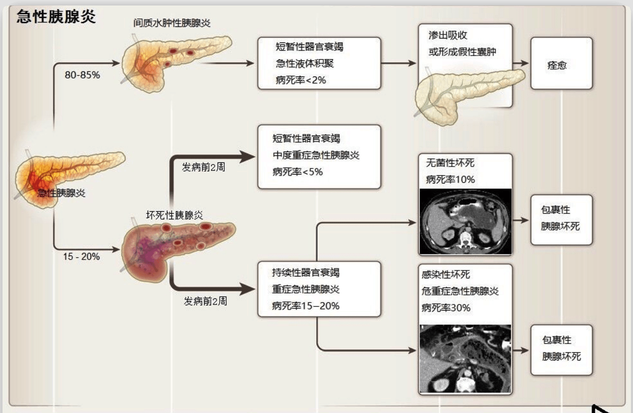 牙周炎怎么办？深度解析治疗方法及预防措施，远离牙龈出血和牙齿松动