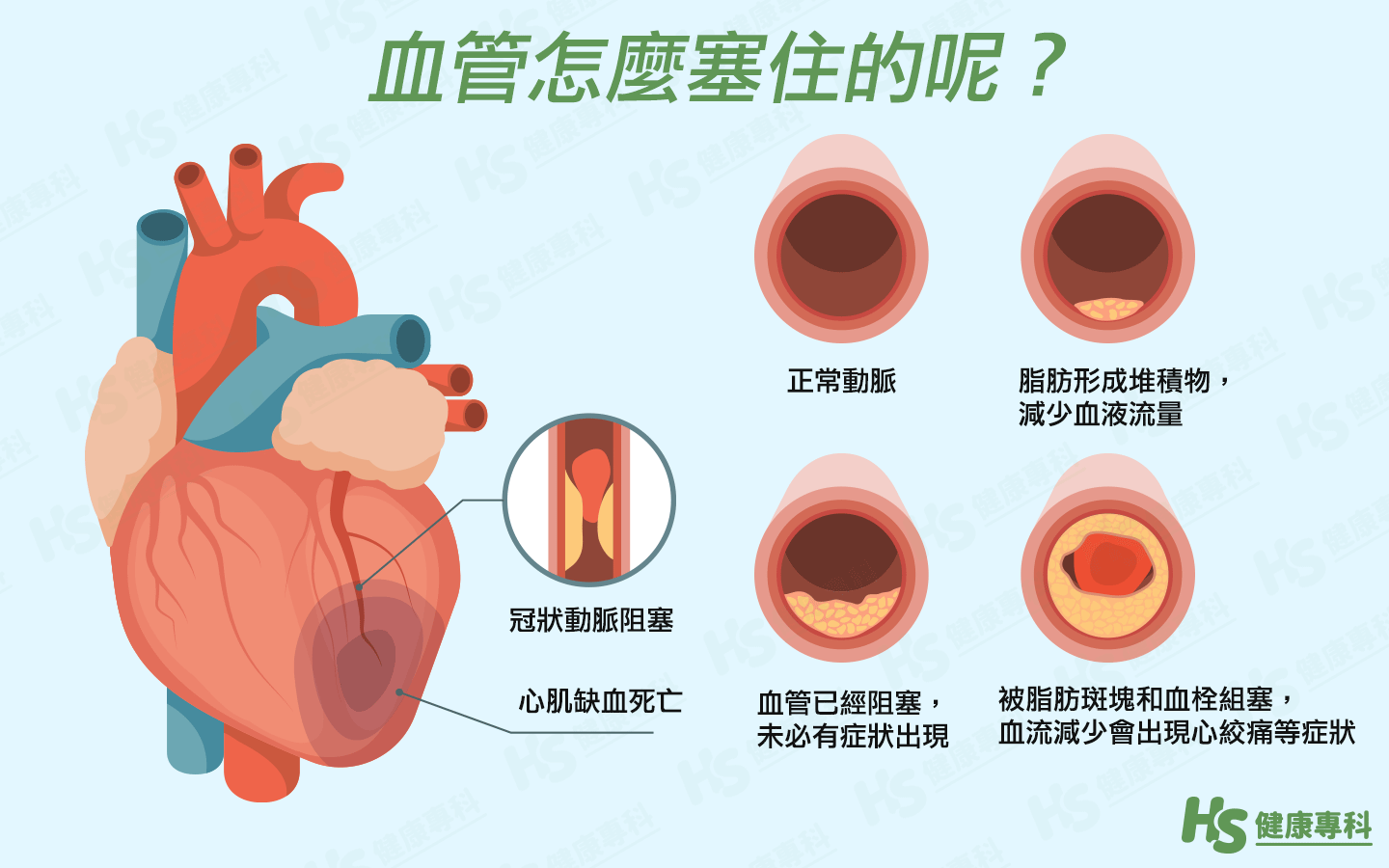 胸口右边疼是怎么回事？可能是这几种原因！