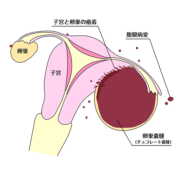 月经完了几天又出血是怎么回事？详解各种原因及应对方法