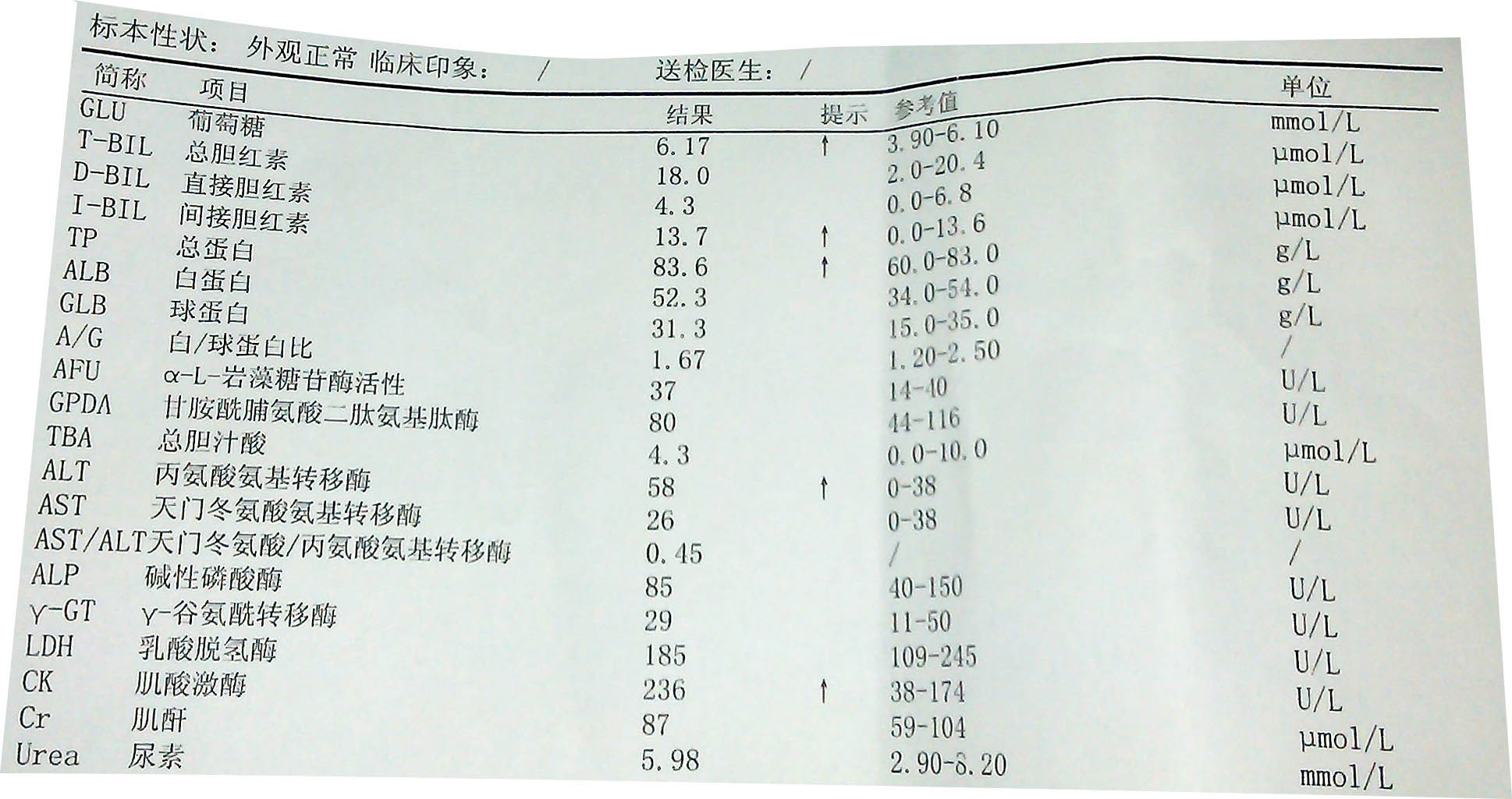 血清谷丙转氨酶高是怎么回事？肝脏健康不容忽视