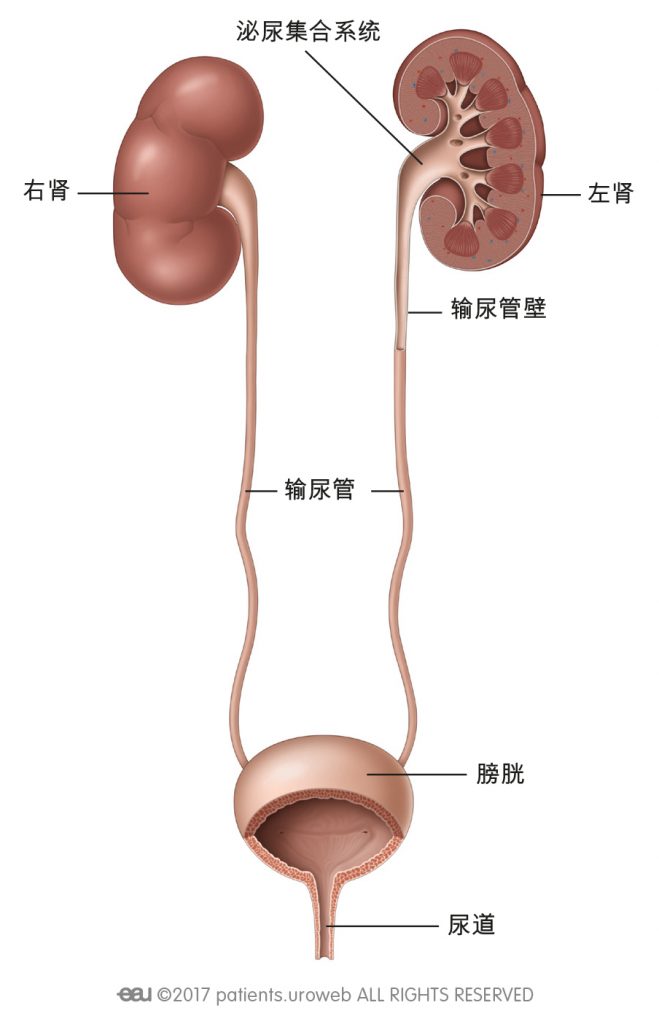 尿管结石怎么快速排出？实用指南及潜在风险详解