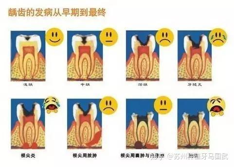 大牙后面肉肿了怎么办？牙龈肿痛的常见原因及处理方法