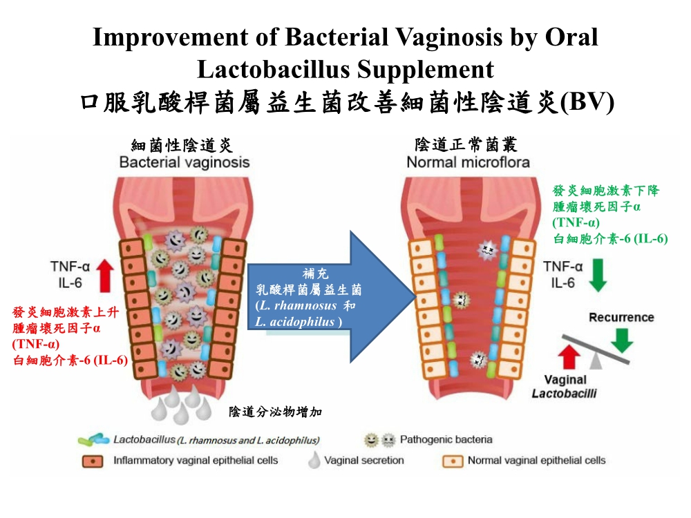 反复馬菌性阴炎怎么根治不复发：从根治到防诊的全面解释