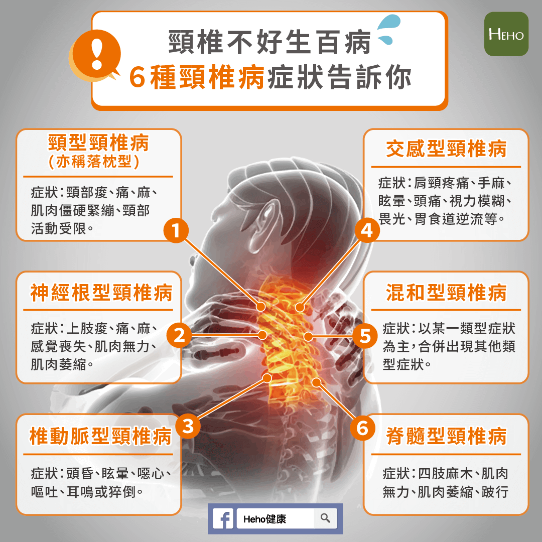 颈椎怎么治疗好？深度解析颈椎病治疗方法及康复策略