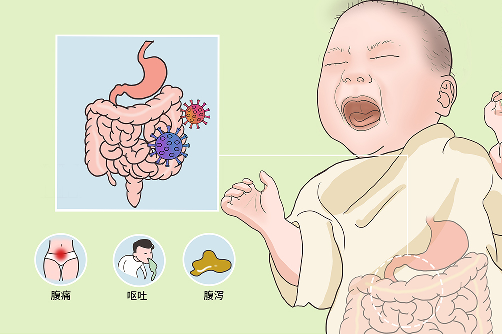 上吐下泻怎么办？家庭急救指南及预防措施详解