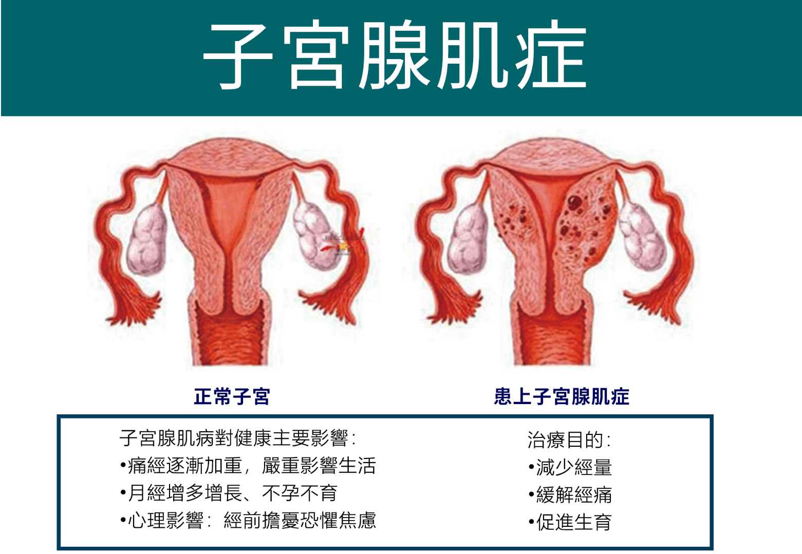 肌无力症状全面解析：有哪些表现？如何有效治疗？