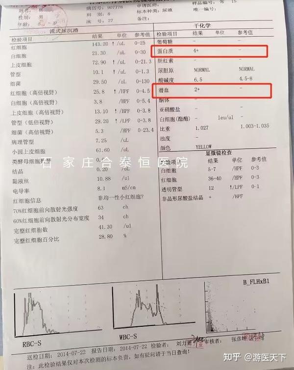 解读肾病综合征最新指南：诊断、治疗及预后策略全解析