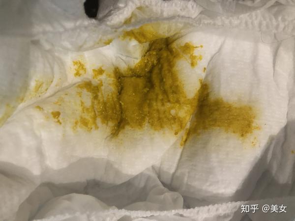 宝宝拉稀怎么办？新手父母必读的实用指南及应对策略