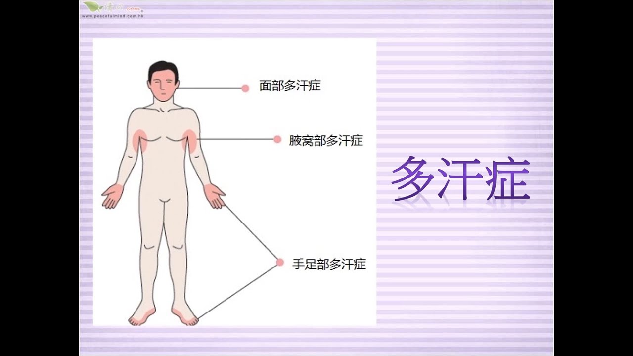 出汗怎么治疗？多汗症的病因、诊断与治疗方法详解