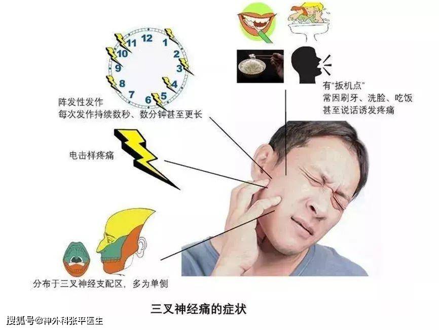 神经疼怎么回事？探秘神经痛的成因、症状及治疗方法